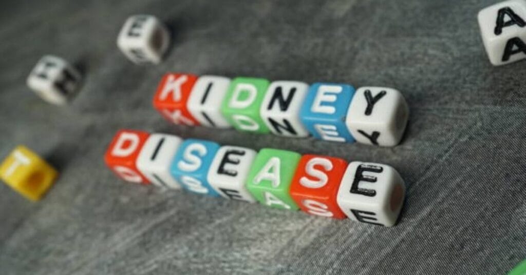 Facts About Kidney Stones